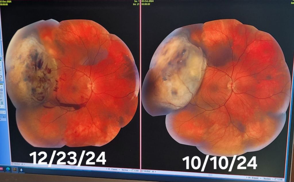 The Great Shrinkage: An Update on Ross and What’s&nbsp;Next