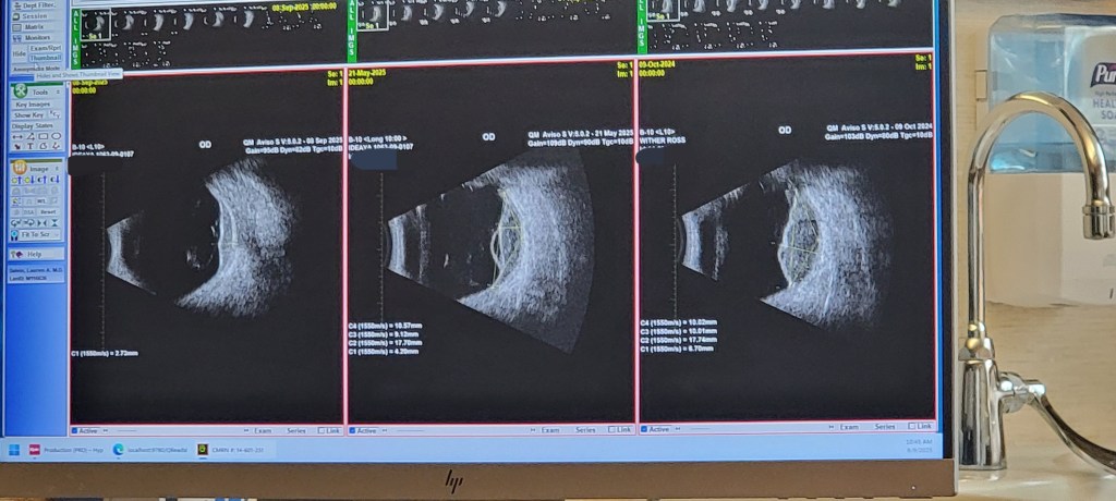 A Journey in Black and White: Reading the Signs of&nbsp;Healing